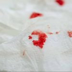 تمیز کردن لک خون تشک