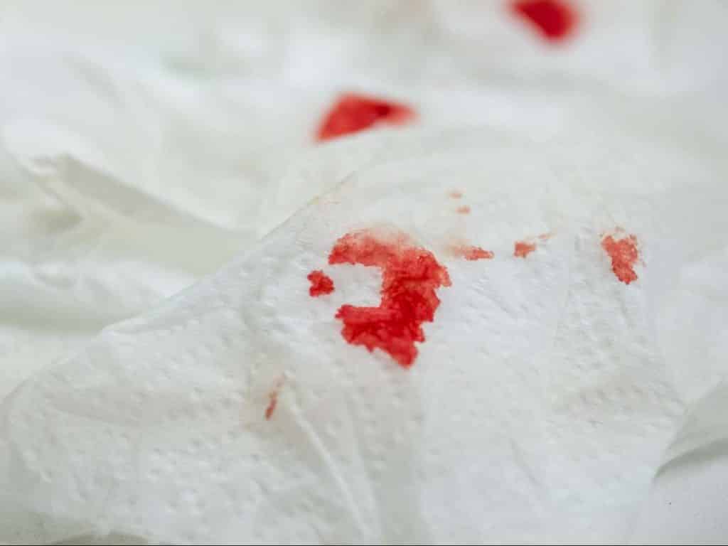 تمیز کردن لک خون تشک