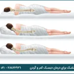 نکات کلیدی در انتخاب تشک برای درمان دیسک کمر و گردن