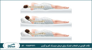 نکات کلیدی در انتخاب تشک برای درمان دیسک کمر و گردن