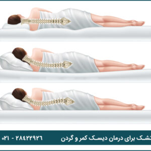 نکات کلیدی در انتخاب تشک برای درمان دیسک کمر و گردن