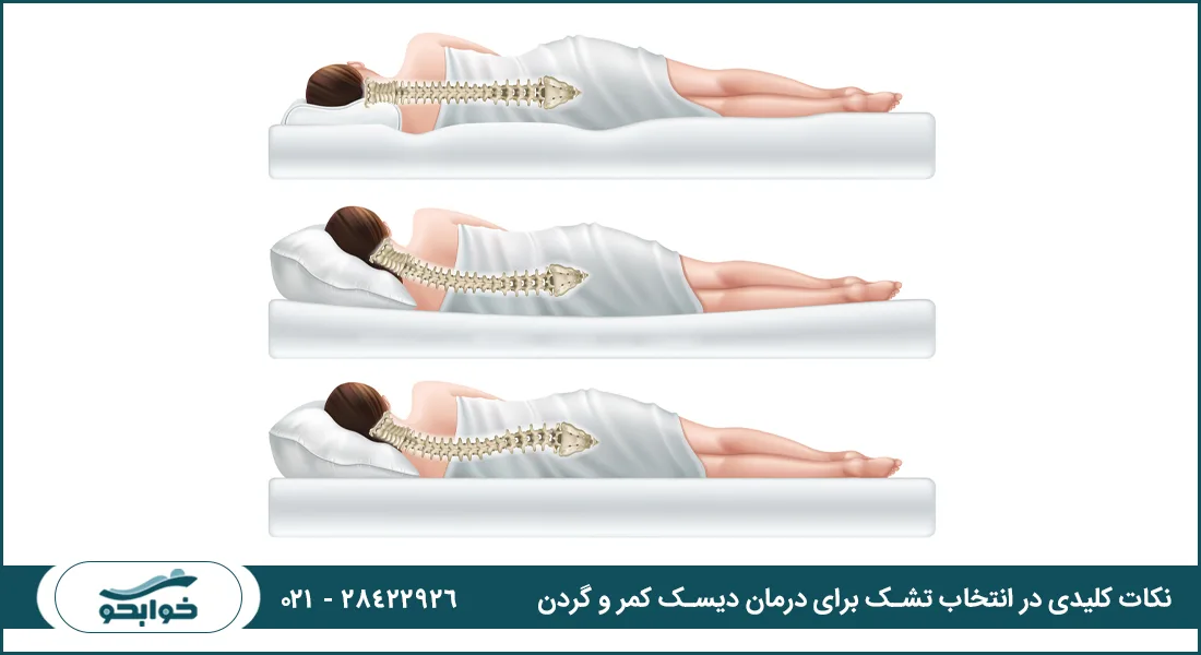 نکات کلیدی در انتخاب تشک برای درمان دیسک کمر و گردن