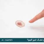 چطور لکه خون را از تشک تمیز کنیم؟